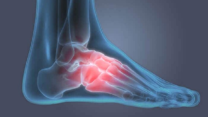 5 Common Foot Injuries And How To Treat Them