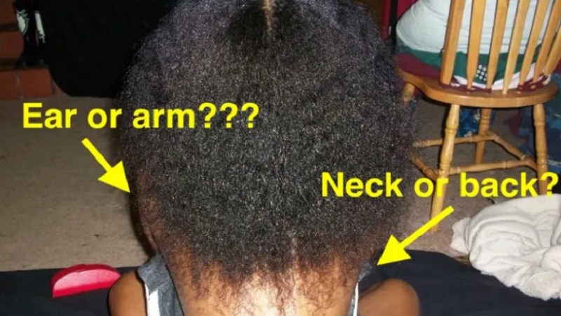 Neck Back