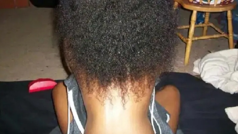 Neck Back